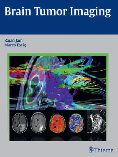 Cover of Brain Tumor Imaging