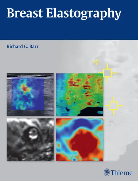 Cover of Breast Elastrography