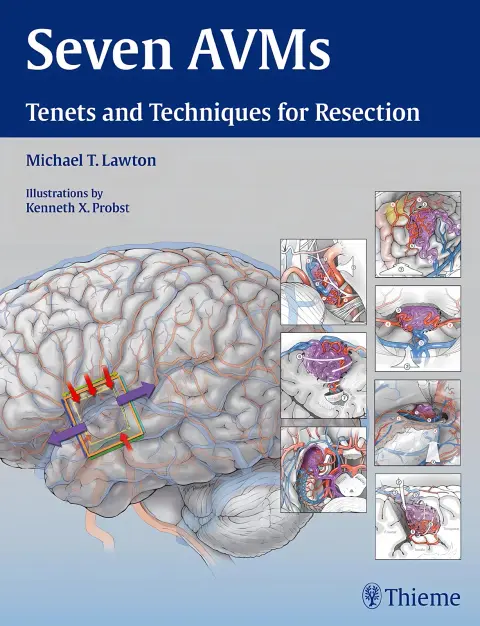 Cover of Seven AVMs