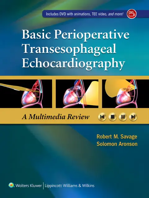 Cover of Basic Perioperative Transesophageal Echocardiography