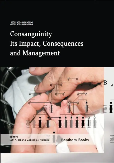 Cover of Consanguinity - Its Impact Consequences and Management
