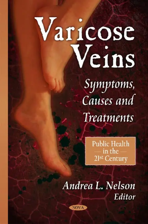 Cover of Varicose Veins