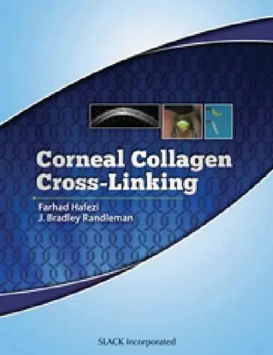 Cover of Corneal Collagen Cross Linking
