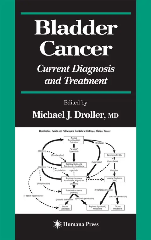 Cover of Bladder Cancer