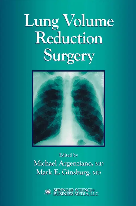 Cover of Lung Volume Reduction Surgery