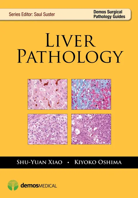 Cover of Liver Pathology