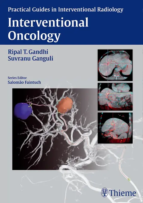 Cover of Interventional Oncology