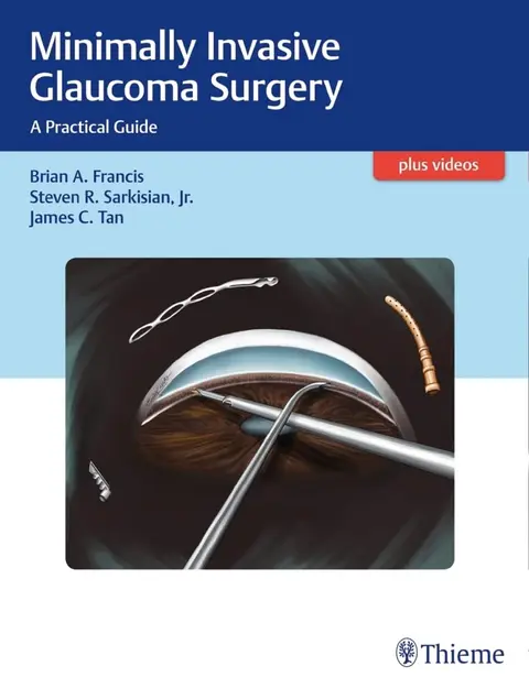 Cover of Minimally Invasive Glaucoma Surgery