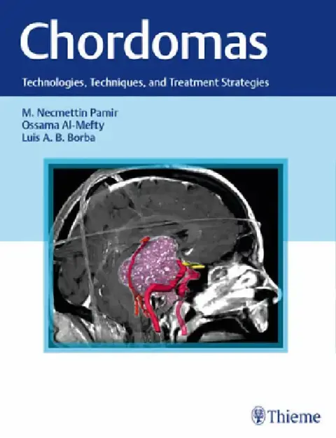 Cover of Chordomas