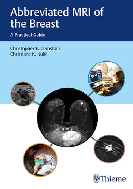 Cover of Abbreviated MRI of the Breast
