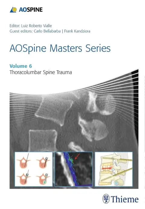 Cover of AOSpine Masters Series, Volume 6