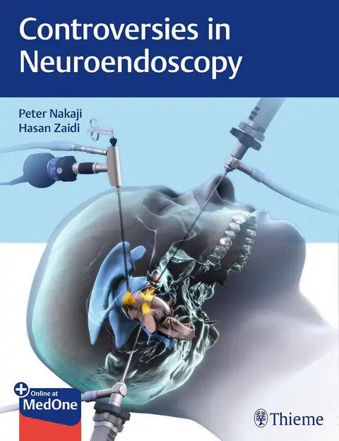 Cover of Controversies in Neuroendoscopy