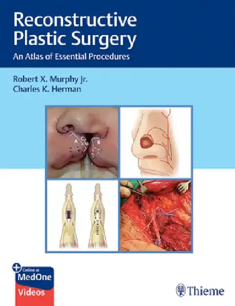Cover of Reconstructive Plastic Surgery