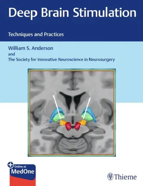 Cover of Deep Brain Stimulation