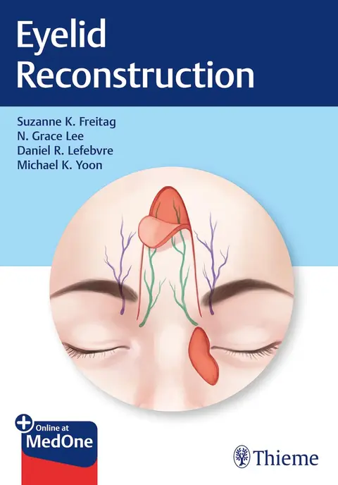 Cover of Eyelid Reconstruction