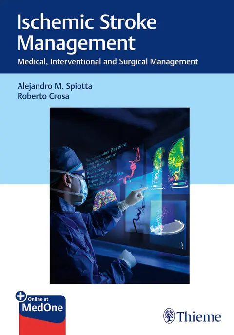 Cover of Ischemic Stroke Management