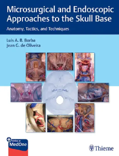 Cover of Microsurgical and Endoscopic Approaches to the Skull Base