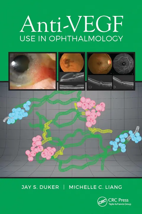 Cover of Anti-VEGF Use in Ophthalmology