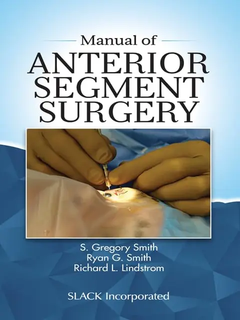 Cover of Manual of Anterior Segment Surgery