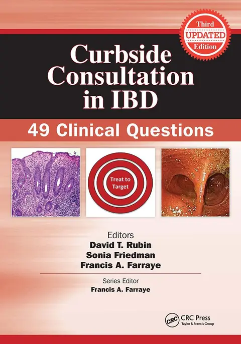 Cover of Curbside Consultation in IBD