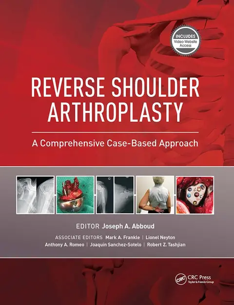 Cover of Reverse Shoulder Arthroplasty