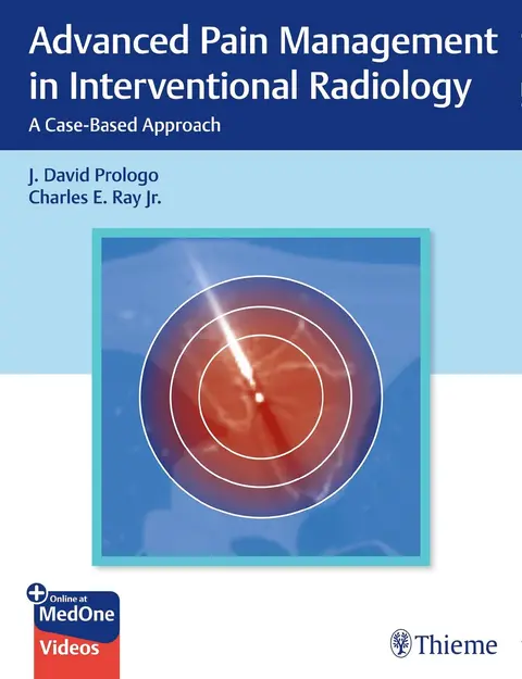 Cover of Advanced Pain Management in Interventional Radiology