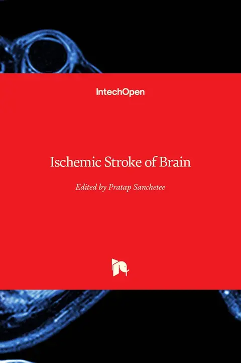 Cover of Ischemic Stroke of Brain