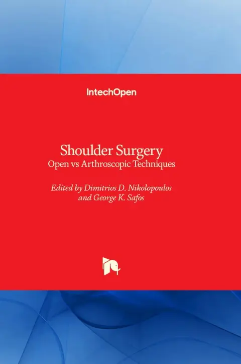 Cover of Shoulder Surgery