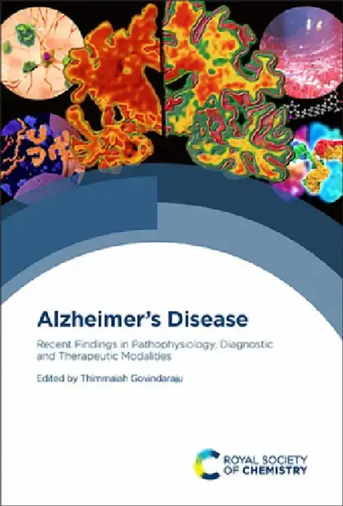 Cover of Alzheimer's Disease
