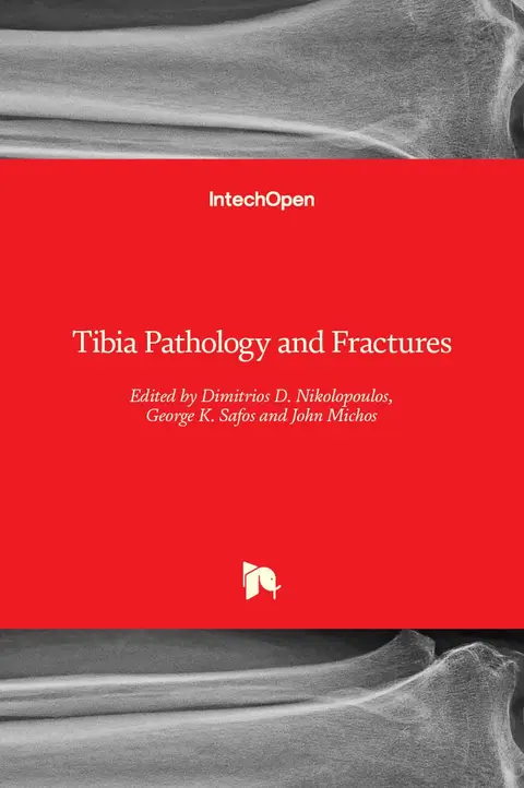 Cover of Tibia Pathology and Fractures