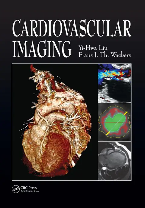 Cover of Cardiovascular Imaging