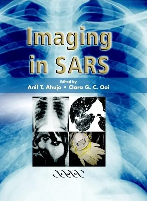 Cover of Imaging in SARS