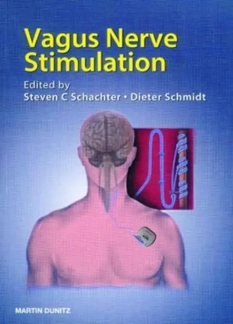 Cover of Vagus Nerve Stimulation