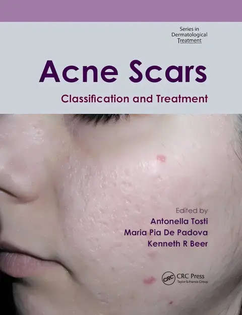 Cover of Acne Scars