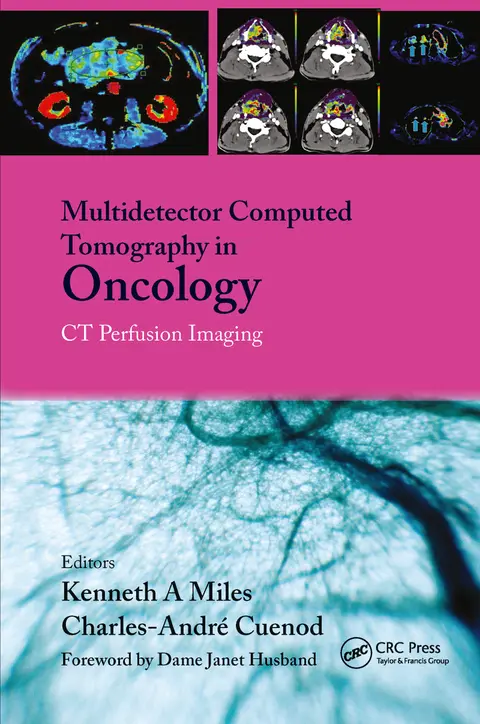 Cover of Multidetector Computed Tomography in Oncology CT Perfusion Imaging