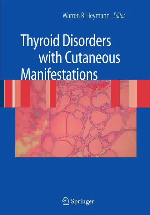 Cover of Thyroid Disorders with Cutaneous Manifestations