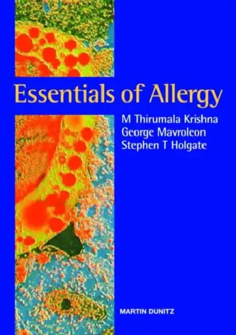 Cover of Essentials of Allergy