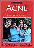 Cover of Acne
