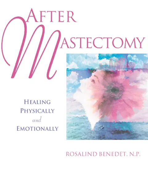 Cover of After Mastectomy