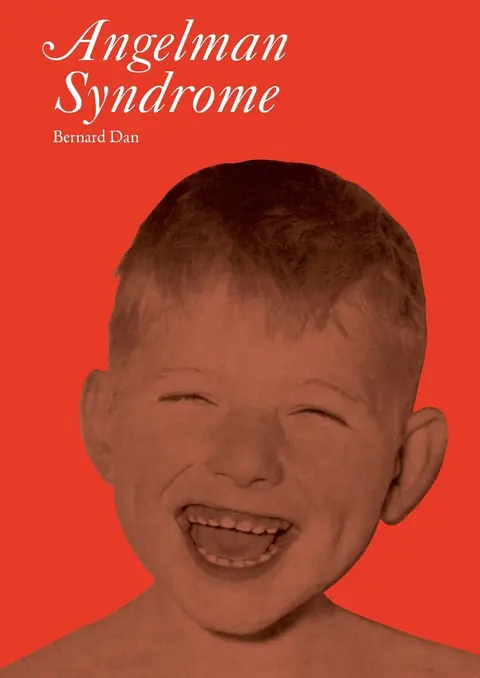 Cover of Angelman Syndrome