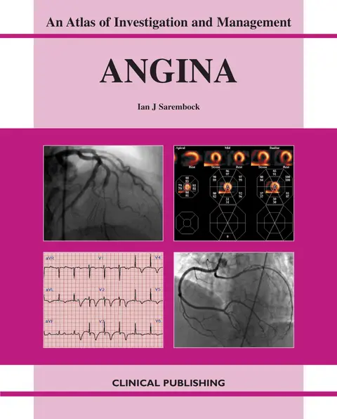 Cover of Angina