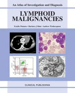Cover of Lymphoid Malignancies