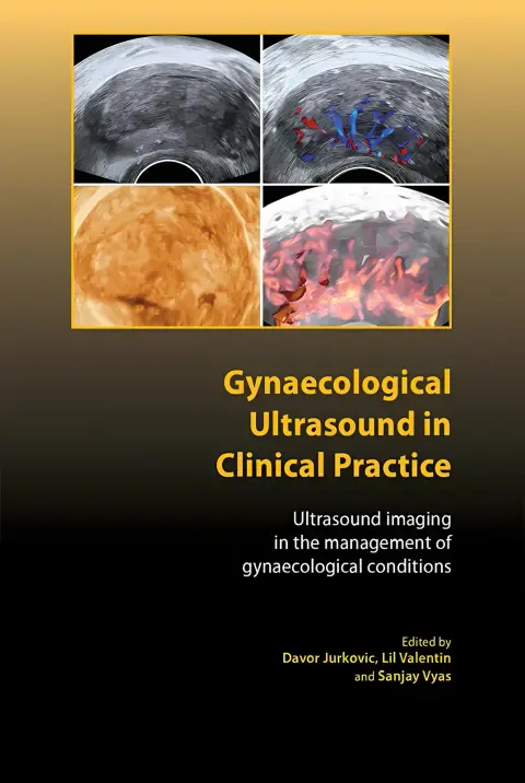 Cover of Gynaecological Ultrasound in Clinical Practice