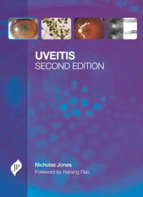 Cover of Uveitis With Cd-Rom