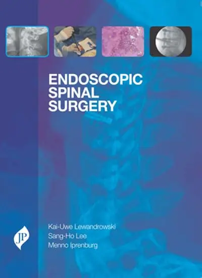 Cover of Endoscopic Spinal Surgery