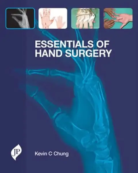Cover of Essentials Of Hand Surgery