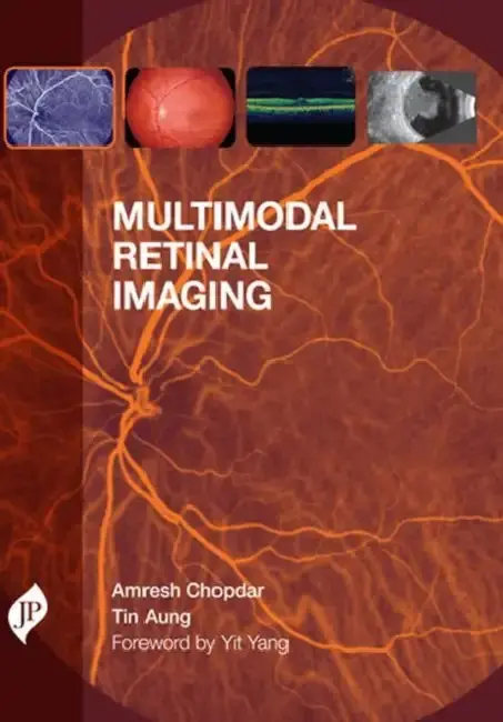 Cover of Multimodal Retinal Imaging