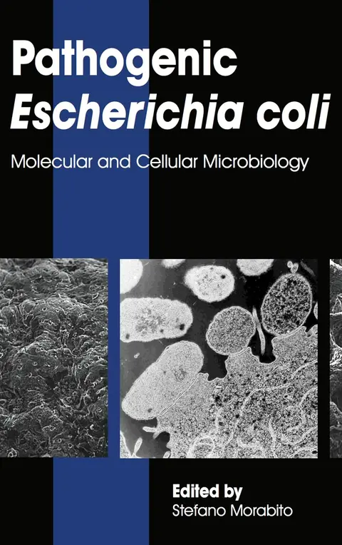 Cover of Pathogenic Escherichia Coli