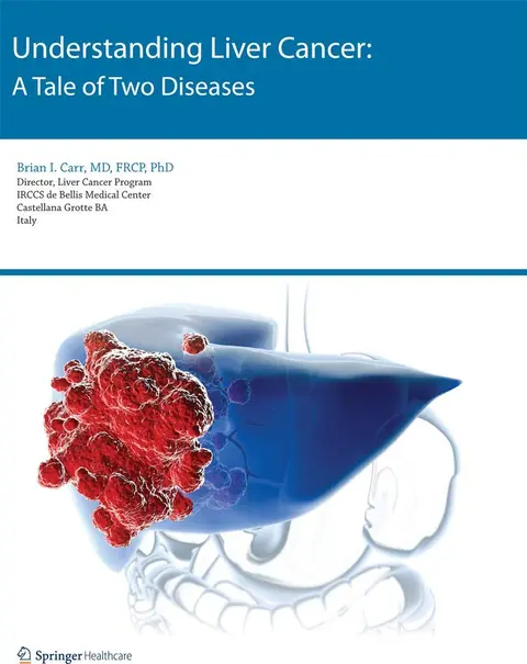 Cover of Understanding Liver Cancer