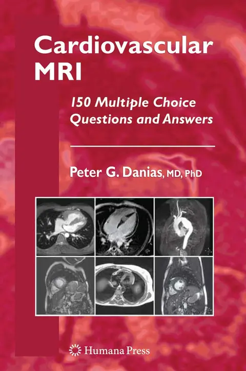 Cover of Cardiovascular MRI